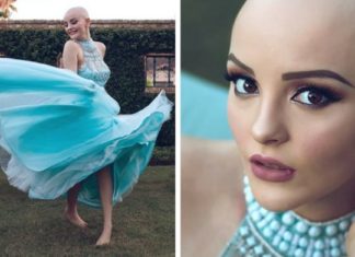 Atteinte d'un cancer à 17 ans, elle pose pour une sublime séance photos