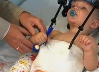 Chirurgie miraculeuse : la tête d’un enfant est rattachée après un accident de voiture
