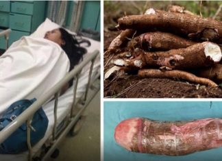 Une femme est hospitalisée d'urgence après s'être masturbée avec un légume! │ MiniBuzz