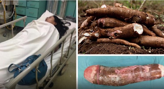 Une femme est hospitalisée d’urgence après s’être masturbée avec un légume!