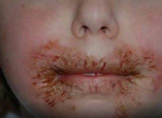 Les docteurs avertissent les parents de ne jamais nettoyer le visage des enfants avec des lingettes pour bébé! │ MiniBuzz