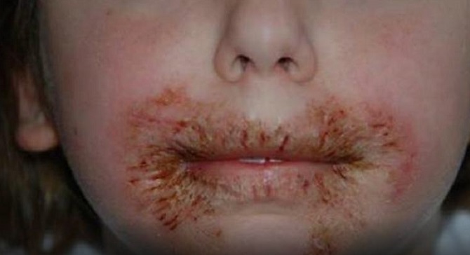 Les docteurs avertissent les parents de ne jamais nettoyer le visage des enfants avec des lingettes pour bébé!