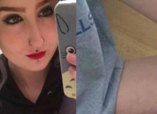 La jeune femme de 19 ans montre ce qu'elle a entre les jambes, car elle dit qu'il ne faut pas avoir honte.