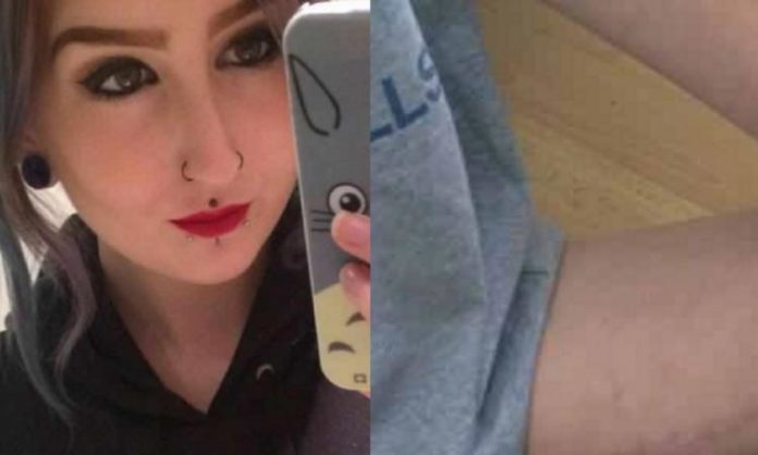 La jeune femme de 19 ans montre ce qu'elle a entre les jambes, car elle dit qu'il ne faut pas avoir honte.